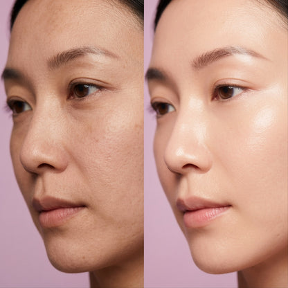 FaceSculpt™ Ice Roller